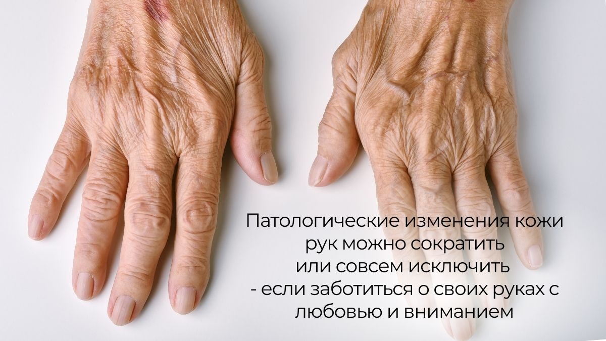 If the skin of the hands will heal itself in just 72 hours, why do you need cosmetics?